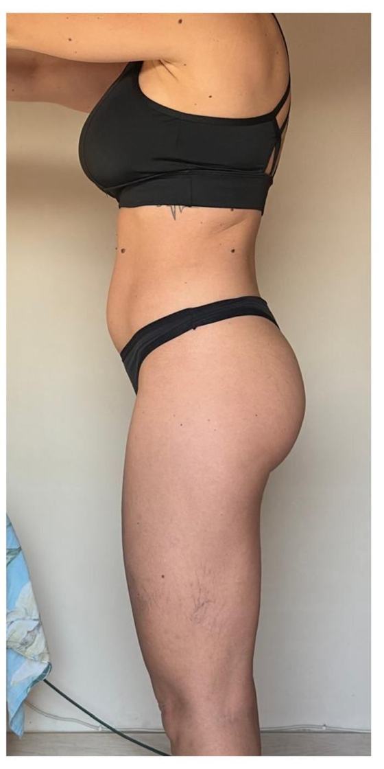 Marina, 52 anni dopo