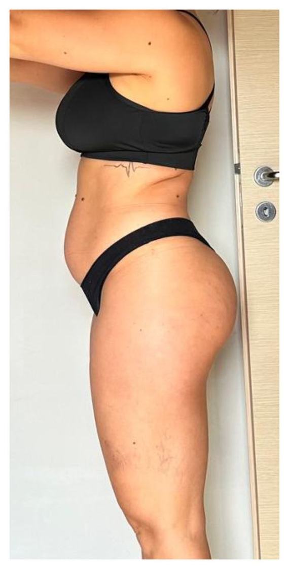 Marina, 52 anni prima