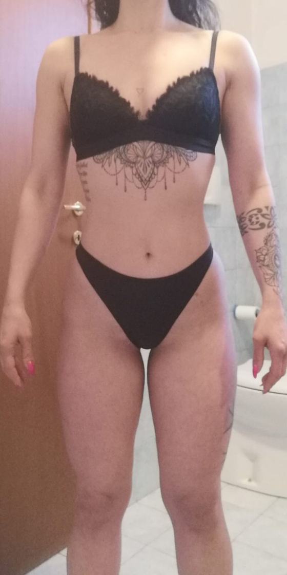 Gambe di Monica dopo il percorso anti-lipedema