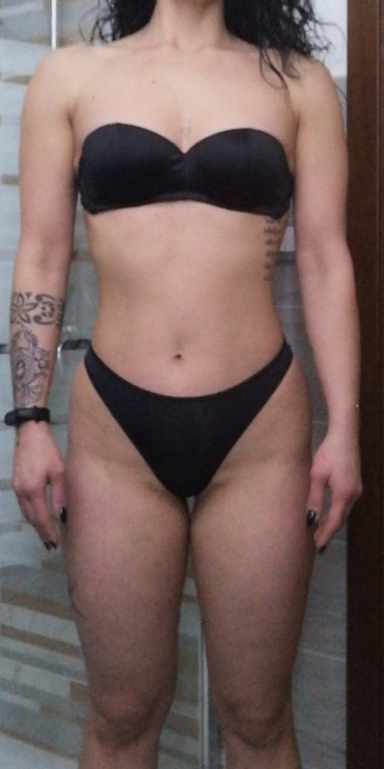 Gambe di Monica prima del percorso anti-lipedema